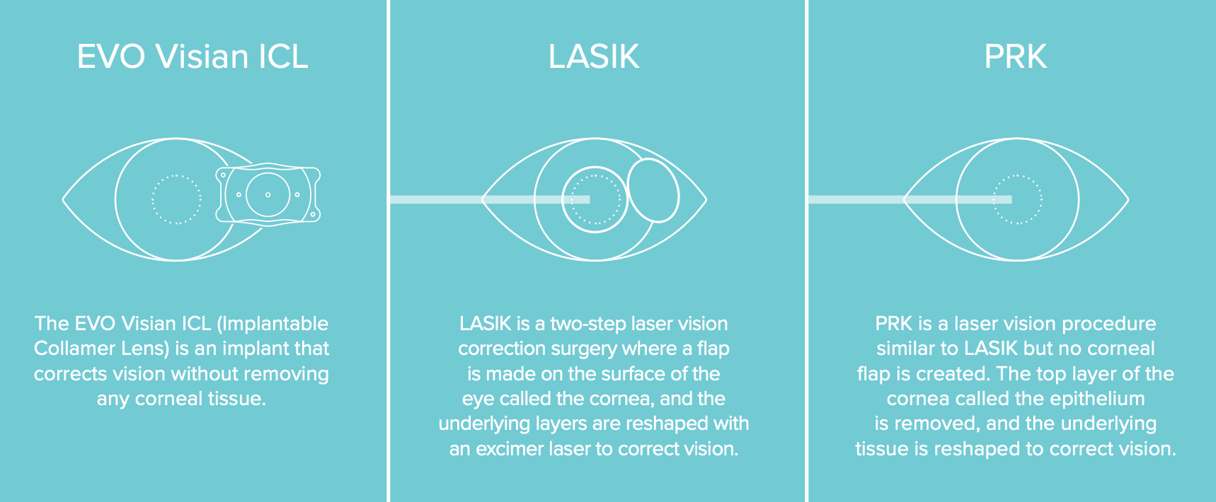 evo lasik prk